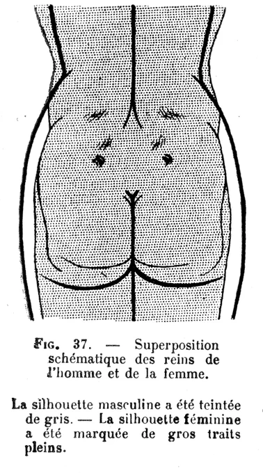 ちなみにこの図がいつも困ったウサギのキャラクターのように見える。外形の性差を示すいい図なんですが。灰色:男性の臀部、白:女性の臀部。鼻がおおよそ仙骨と尾骨の境界、目が上後腸骨棘、眉毛が腰三角上の脂肪体。 