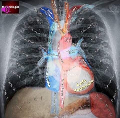 PowerpointsRt's tweet image. Do you recall your anatomical structures? #anatomicalstructures #pulmonary #medicine #respiratory #RTpowerpoints