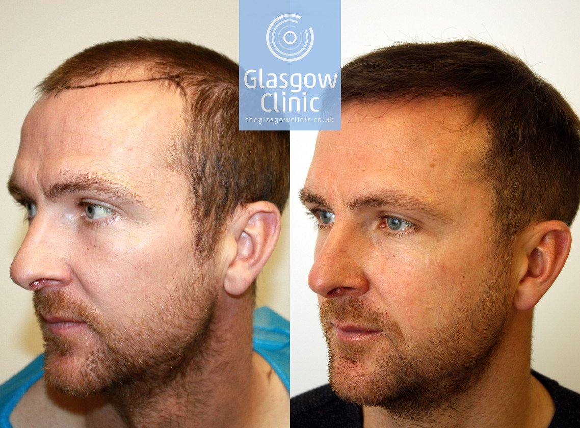 Theglasgowclinic Glasgowclinic Twitter