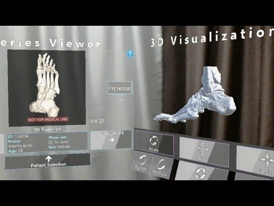 LionelREICHARDT's tweet photo. How mixed reality is changing the game for healthcare, from performing live surgeries to delivering ultrasounds in 3D | Windows Experience Blog #esante #hcsmeufr #digitalhealth #sim4health https://t.co/muTVVNedOg https://t.co/cK2tujI9Kn