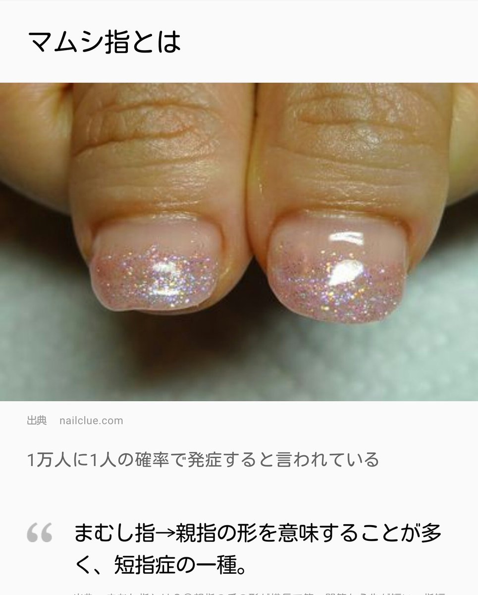 おぱんつ Pa Twitter こんぴちゃんが言ってる1万人に1人は おぱんつ Pa Twitter こんぴちゃんが言ってる1万人に1人は