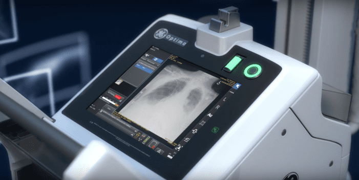 GEHealthCare's tweet image. This #AI software can flag acute cases of collapsed lung, improving #triage invent.ge/2C4pMgp