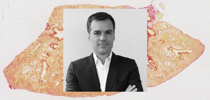 Gometmedia's tweet photo. 💊 La biotech marseillaise @Biocellvia lance une nouvelle levée de fonds d’un million d’euros. Objectif : étoffer ses équipes et booster sa notoriété. À lire sur @GometSante ➡ https://t.co/OaSKMquzLw https://t.co/fqdluLPSds
