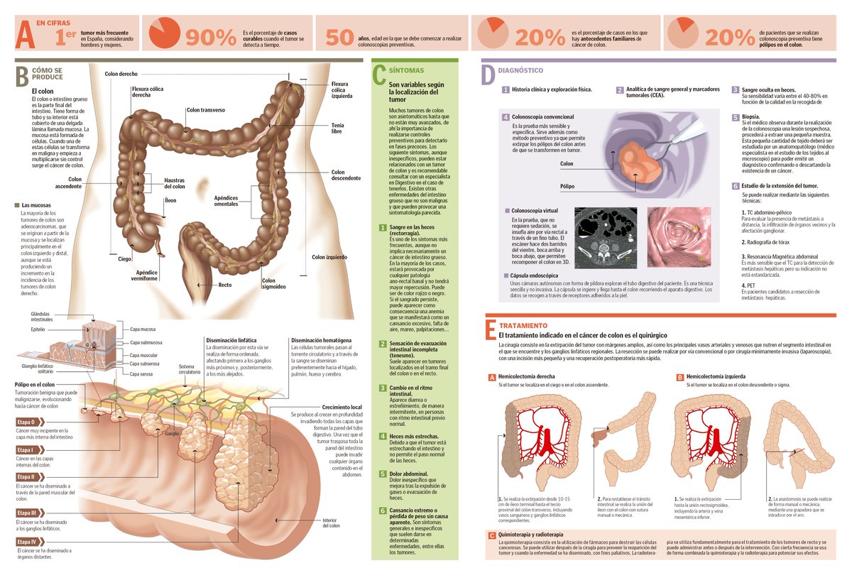 Sintomas de cancer intestino delgado