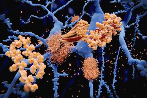 sciam's tweet photo. Could Alzheimer's be a reaction to infection? A relatively new and still controversial theory suggests the disease could be triggered by pathogens https://t.co/nfnemlkg3s https://t.co/UpqucyMEOQ
