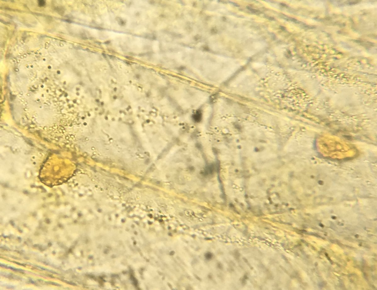 GeoffMorganBio's tweet photo. S2 Biologists have been making 🔬 slides of 🌱 cells and 👫 cells this week https://t.co/epL4q3Cnrt