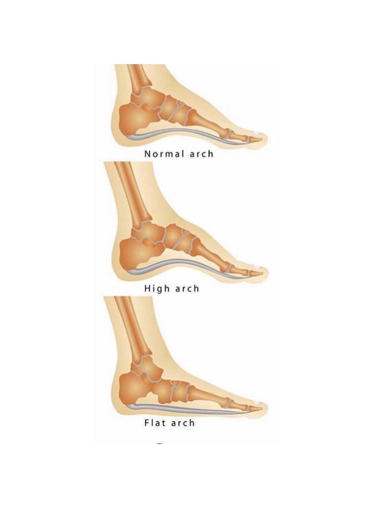 CalBReflexology's tweet photo. In Reflexology the arches of the feet represent the spinal reflexes &amp; central nervous system reflex area. If you suffer from back or neck problems why not give reflexology a try? To book call 07951 022050 #reflexology #reflexologist #liverpoolcitycentre #liverpool https://t.co/LHEMMonFHt