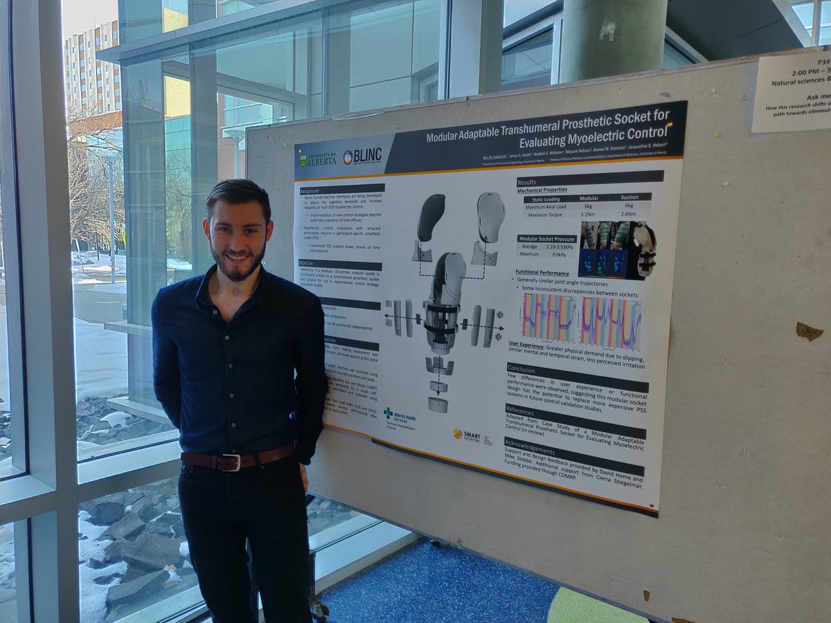 awshehata's tweet photo. Ben presenting recent results for a 3D printed adaptable socket for persons with above elbow amputation #BLINClab @SMARTNetwork8 @UofARehabMed https://t.co/OnTvUC7gMm