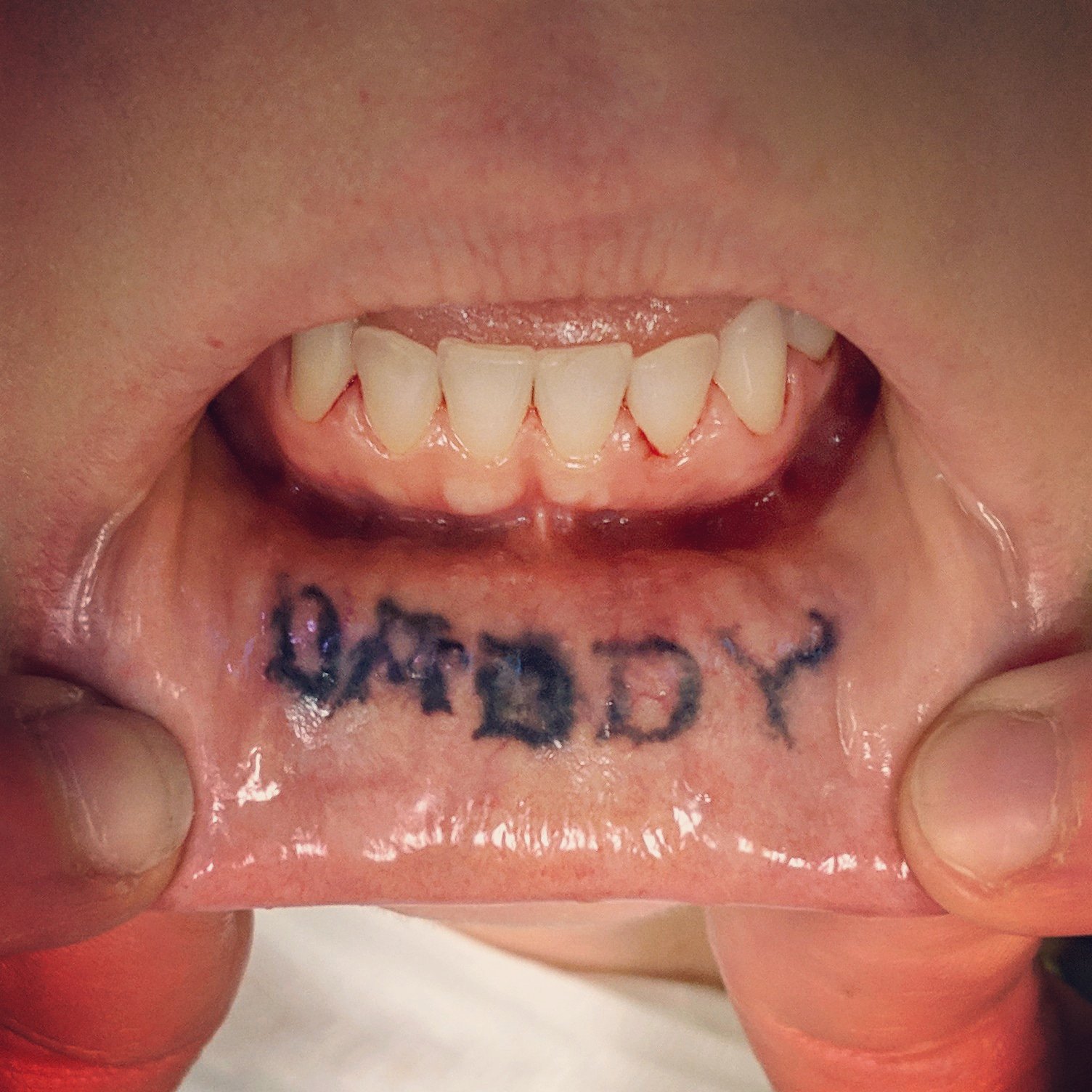 Dental Elements on X: "Another 'DADDY' lip tattoo showed up today, so we had to grab a quick photo! - Contact us at 303-309-4093 to schedule an appointment or learn more about