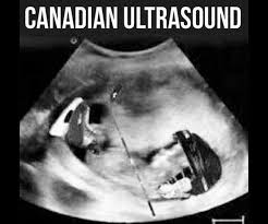 CourseCappin's tweet photo. Nice!
-
-
-
#CourseCap #capture #homework #vancouver #study #funny #memes #tutor #college #likeforlikes #instagood #class #canadian #ultrasound #hockey #canada https://t.co/yewzsZlmHh