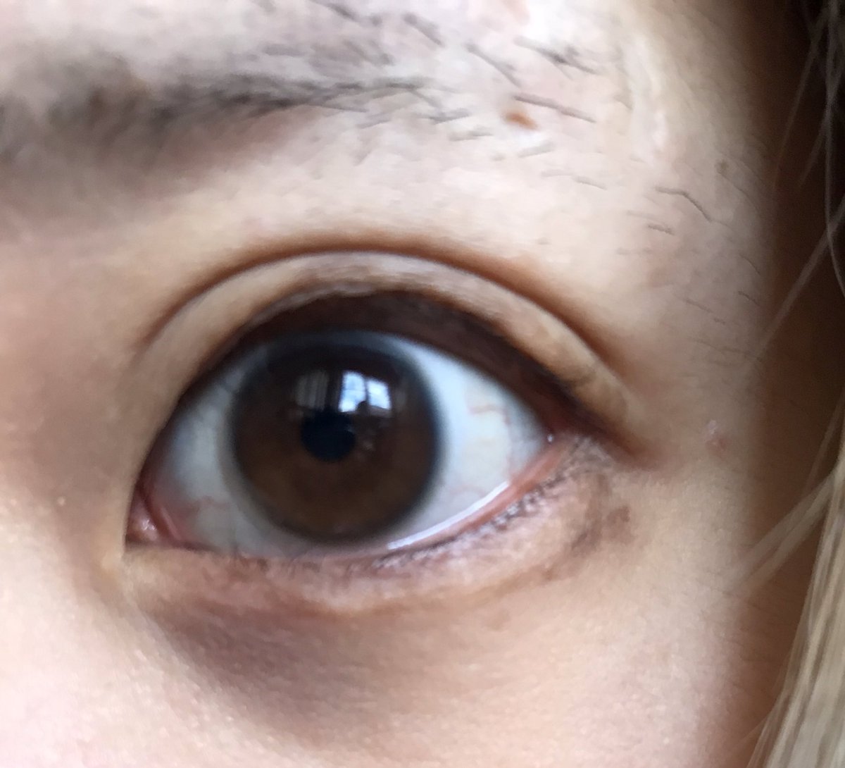 瞳孔開く目薬すげぇ 右目だけめっちゃ瞳孔開いて動物の目みたいになっとる 片目だけ瞳孔開いとるから違和感しかないし片目だけ異様に眩しいし近くのもん見えん 瞳孔開く目薬すげぇ 右目だけめっちゃ瞳孔開いて動物の目みたいになっとる 片目だけ瞳孔開いとるから違和感しかないし片目だけ異様に眩しいし近くのもん見えん