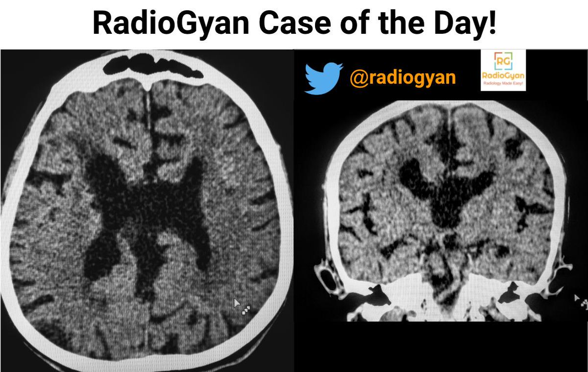 Amar Udare, MD - RadioGyan.com tweet media