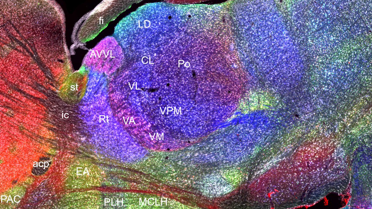 MRC BNDU, Oxford (@mrcbndu) on Twitter photo Introducing <a href="/MRCBNDU/">MRC BNDU, Oxford</a>’s CHAMBER project – A new chemoarchitectonic atlas of mouse thalamus + other brain regions. #openscience #imaging (data.mrc.ox.ac.uk/chamber). Special thanks to <a href="/openmicroscopy/">openmicroscopy</a> #OMERO for help. <a href="/The_MRC/">Medical Research Council</a> <a href="/OxfordMedSci/">Medical Sciences</a> <a href="/RR_Oxford/">Reproducible Research Oxford (RROx)</a> Introducing <a href="/MRCBNDU/">MRC BNDU, Oxford</a>’s CHAMBER project – A new chemoarchitectonic atlas of mouse thalamus + other brain regions. #openscience #imaging (data.mrc.ox.ac.uk/chamber). Special thanks to <a href="/openmicroscopy/">openmicroscopy</a> #OMERO for help. <a href="/The_MRC/">Medical Research Council</a> <a href="/OxfordMedSci/">Medical Sciences</a> <a href="/RR_Oxford/">Reproducible Research Oxford (RROx)</a>