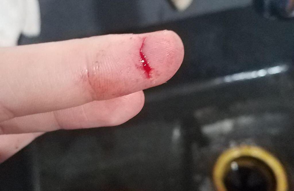 The_MorningMess's tweet photo. Should Jeana learn to do stitches on her husband so they can save some money?! https://t.co/XOuPM4WhHQ