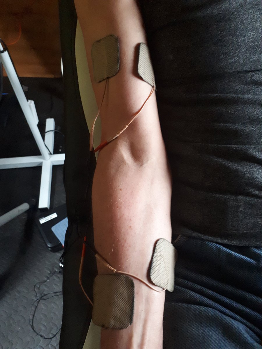 WayneDowell2's tweet photo. Struggling with elbow or forearm pain why not book in for an initial assessment and treatment https://t.co/CT4bKm27pS