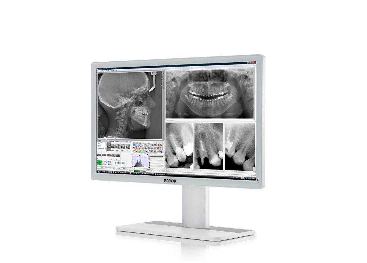 BarcoHealth's tweet photo. Come and meet this beauty at #IDS2019 #dental show at our partner booths @duerrdental @CarestreamDentl @OrangeDentalA @GerlDental @MerzDental and @HScheinDental https://t.co/y9flvZbeRW