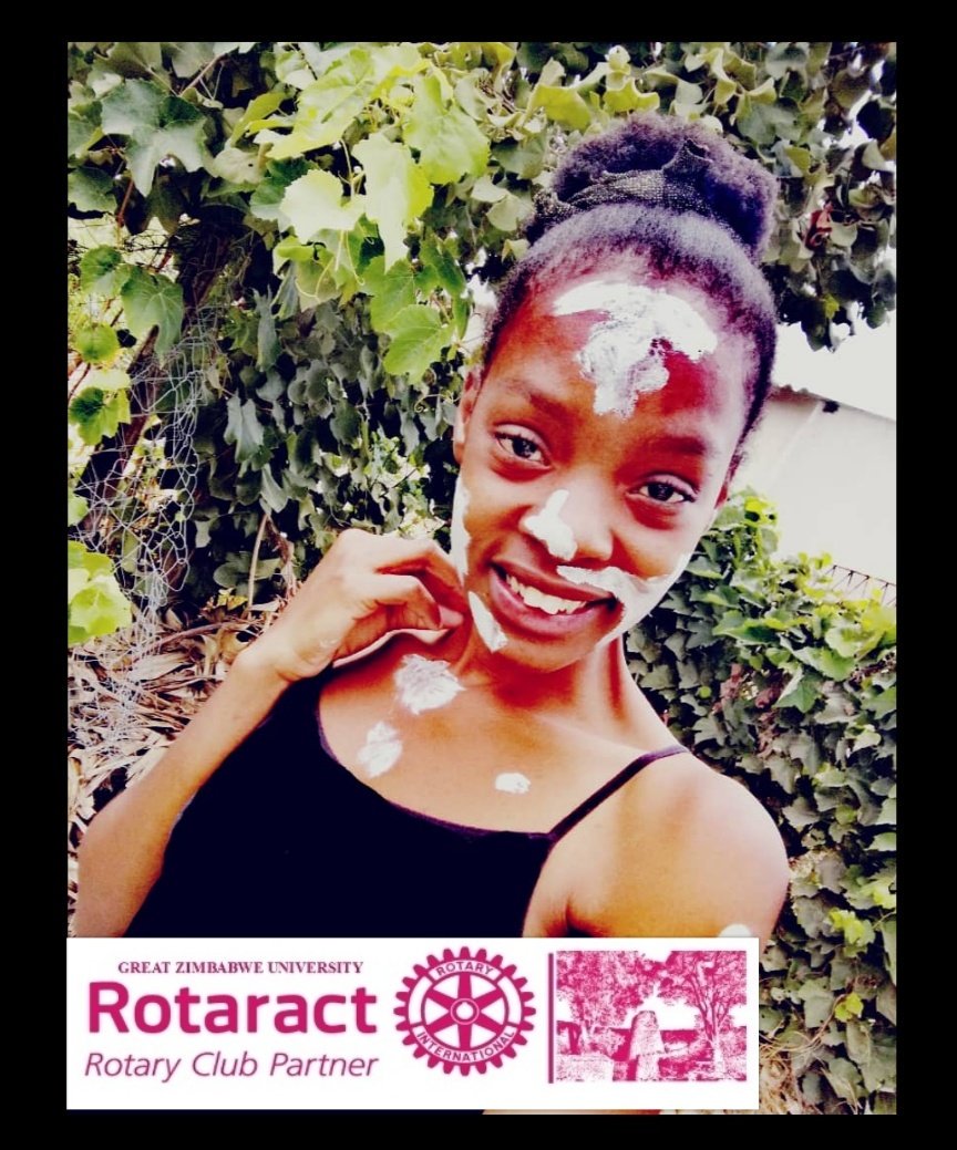GzuRotaract's tweet photo. Iam proud of who i have become so be happy with me and love me as you always did before.. Inside iam still me
#Melanin
#howifeelwithvitiligo
#D9210
#rotaractworldweek
#RCSIES https://t.co/8SC9eEXFb8