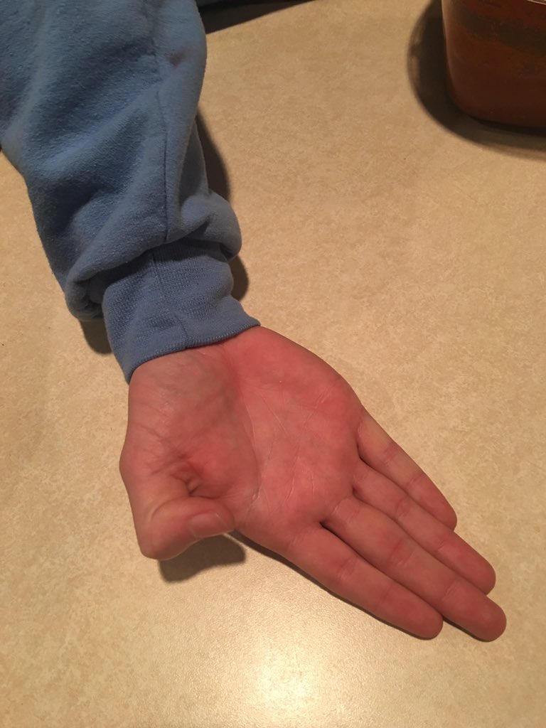 evaluez's tweet image. Teenager evolution #textingdigit