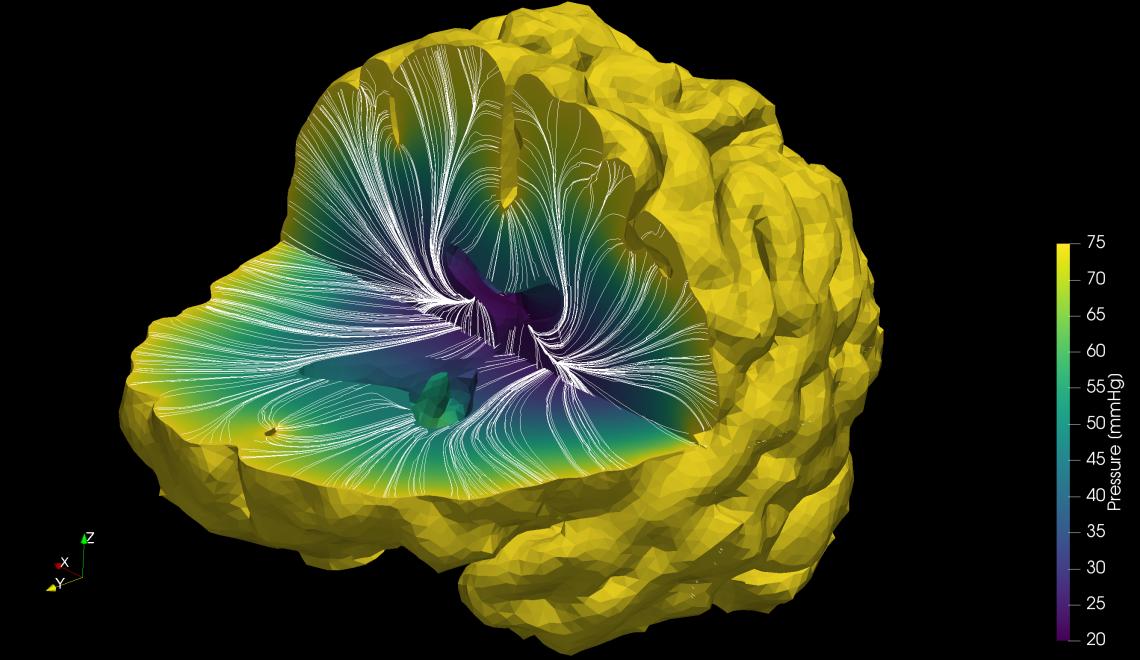 OxfordSparks's tweet photo. Science Blog: Mathematical models developed for the oil industry may transform the way we bring stroke drugs to market https://t.co/31smIeAt31 #learningbrain @ScienceWeekUK @oxengsci https://t.co/hPmwhKFhIt