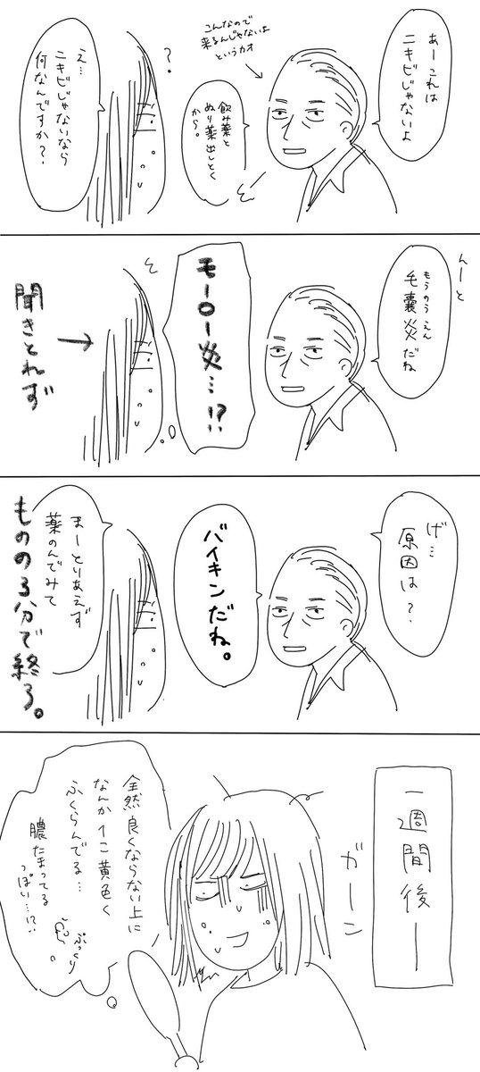 ニキビで初めて病院に行ってみた話 