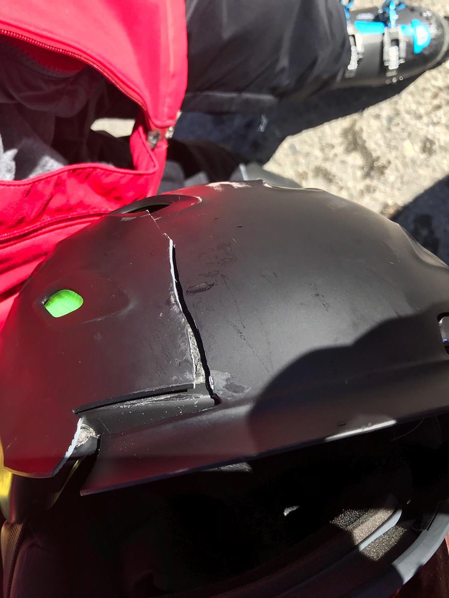 SophieJacob123's tweet photo. I’ve taught so many people skiing who refuse to wear a helmet, because they weren’t ‘cool’(honestly), ‘too uncomfortable’ or had a ‘never worn one so why start now?’ attitude.This is my bro’s after he had a crash today, luckily OK but could have been far worse.BESAFETOHAVEFUNYALL https://t.co/Ko3zBZOFkz