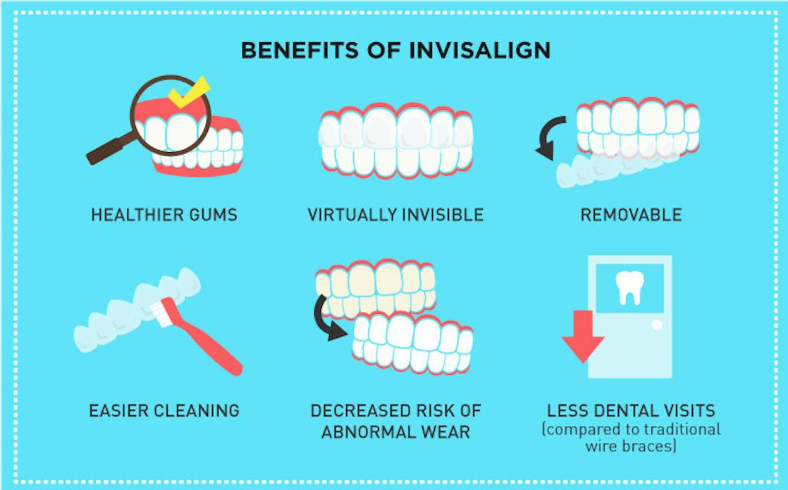 AgapeDentalYEG's tweet image. When seeking orthodontic treatment, there are a few efficient and effective options out there, but none quite like Invisalign. Gain the benefits of Invisalign for as low as $50 per week. #invisalignprovider #benefitsofinvisalign #orthotips #orthodontics #straightteeth #yegdentist