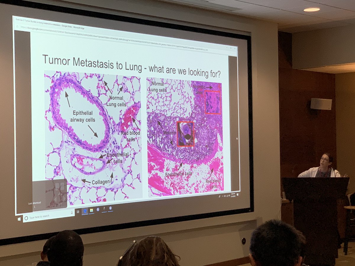 LJIMicroCore's tweet photo. Paola Marcovecchio talks about teaching a machine learning algorithm within @QuPath how to identify melanoma!
#ljiqupath https://t.co/GXmFQAyVeW