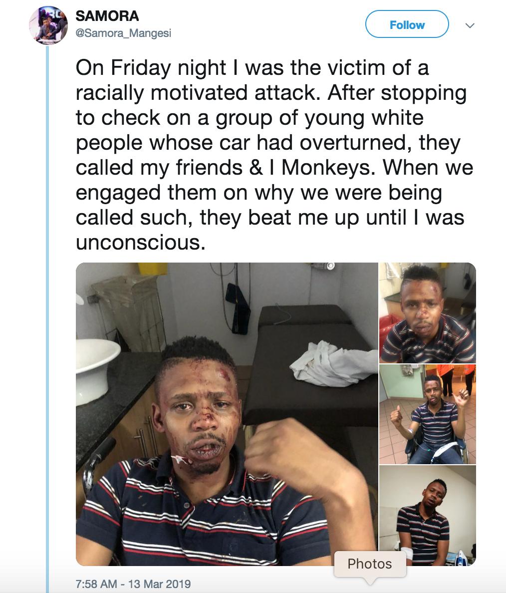 Aj On Twitter A Black South African Tv Presenter Says He Was Attacked And Beaten Unconscious By A Group Of White People After He Stopped To Help Them With Their Car Samora