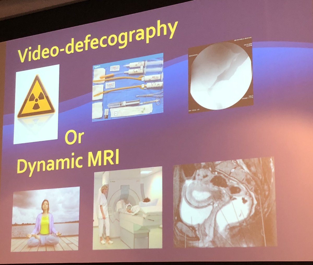 MR proctography:see organs but on the side
DPG: don’t see organs, more physiological
Dr Roche has the answer...FTRP and defaecatory fluoro DPG better, but cystocele MRP better