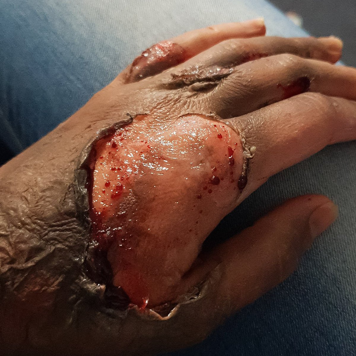 ByKahli's tweet photo. #sfx #makeup #makeupartist #burn #hand #MakeupMadness #specialeffectsmakeup https://t.co/4IWfbL98sd
