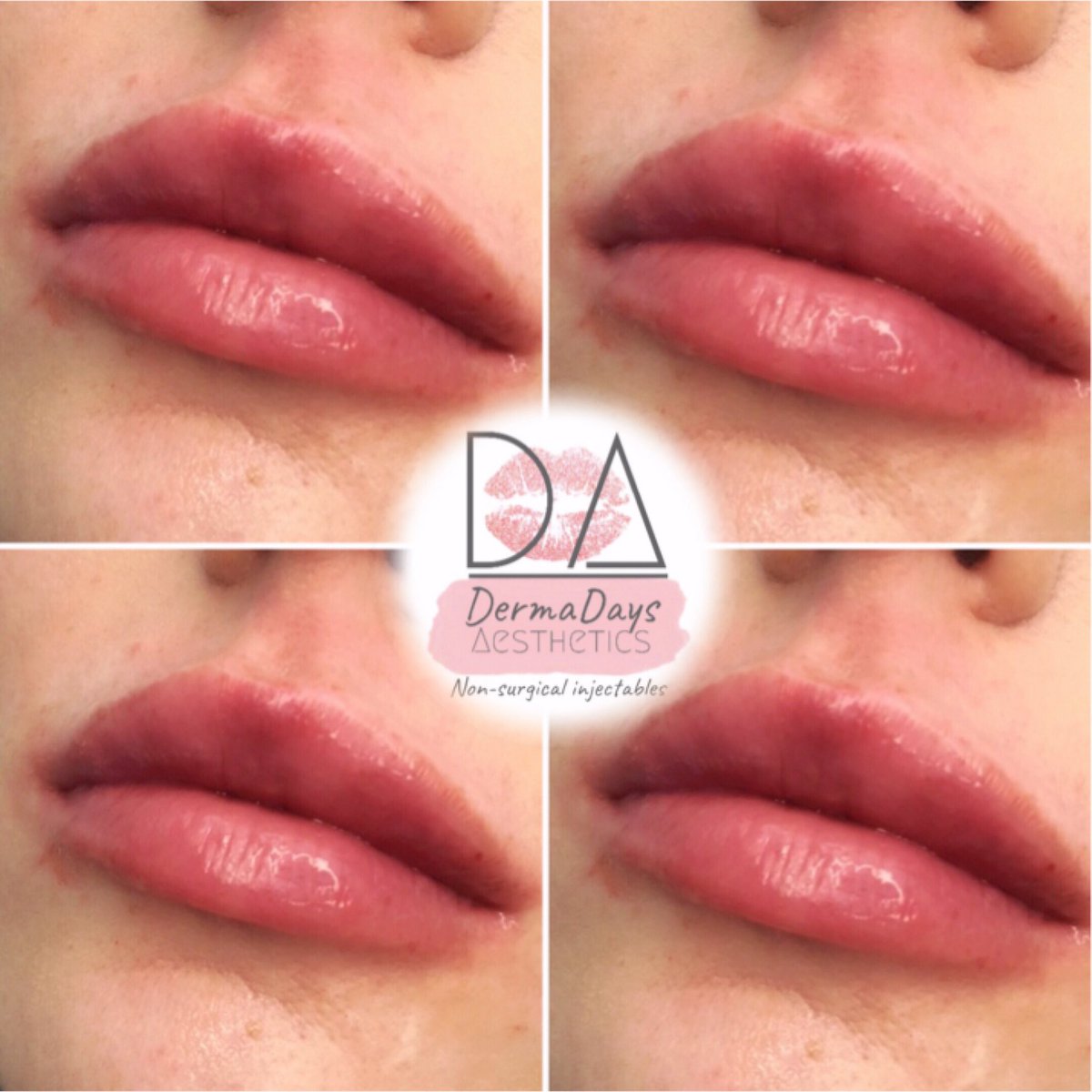 DermaDays Aesthetics tweet media