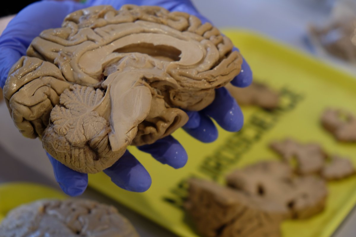 NYU_HSL's tweet photo. Another great #BrainWeek in the books! Thanks to @nyulangone @BioBus @ComeBeBraiNY @dana_fdn @firmenich #StephanieRogers #HumanisticMedicine #LauraFerguson for a banner year! #NYUneuroscience #brains #brainweek2019 @neurogirlNYC https://t.co/8cbt5XCnVI