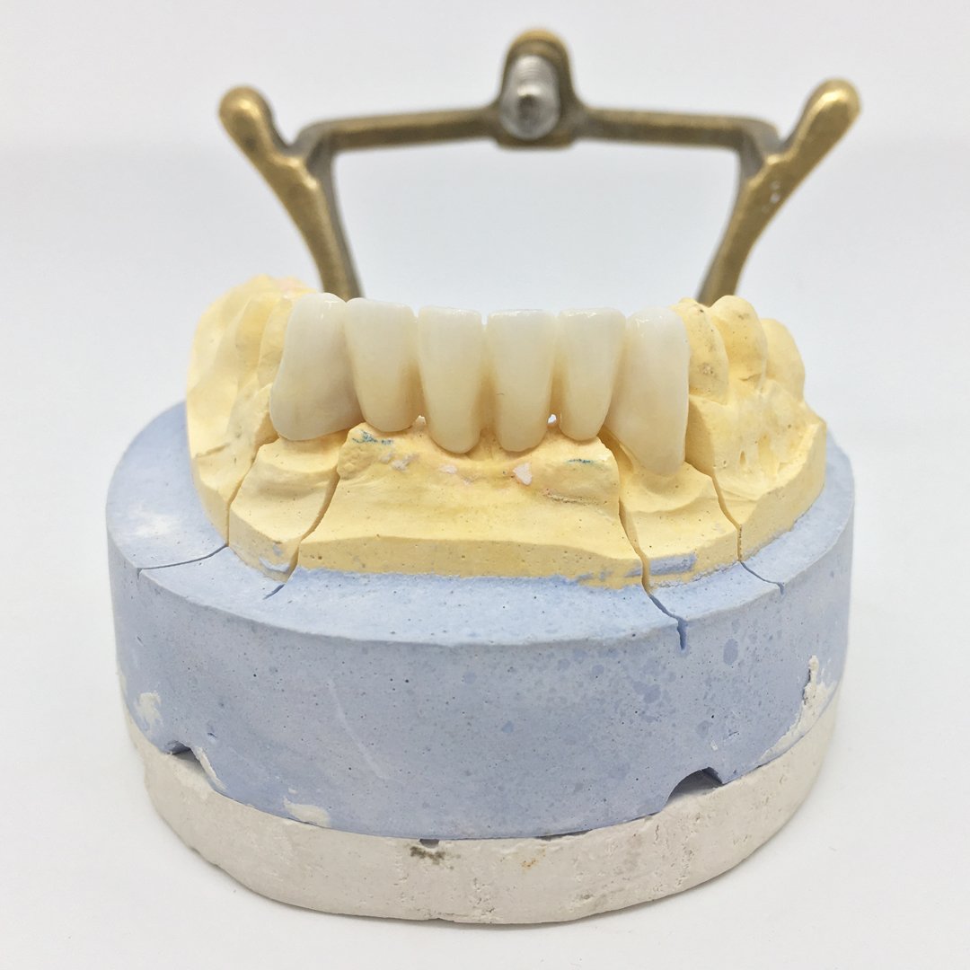 jpdentallab's tweet photo. #LaboratorioDental Partimos hacia la mejora dental, de los pacientes, que las #ClinicaDental nos confían sus sonrisas. Adaptándonos a cada doctor 🦷 elaborando y solucionando las #ProtesisDental necesarias. 
 #BadalonaDental ¿Te ayudamos? https://t.co/NIUUxGCKNG https://t.co/A09eRjM9B0
