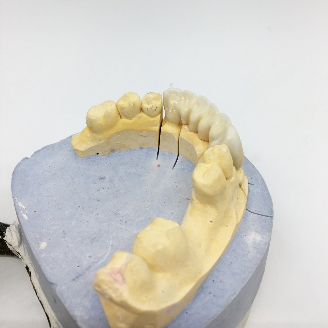 jpdentallab's tweet photo. #LaboratorioDental Partimos hacia la mejora dental, de los pacientes, que las #ClinicaDental nos confían sus sonrisas. Adaptándonos a cada doctor 🦷 elaborando y solucionando las #ProtesisDental necesarias. 
 #BadalonaDental ¿Te ayudamos? https://t.co/NIUUxGCKNG https://t.co/A09eRjM9B0