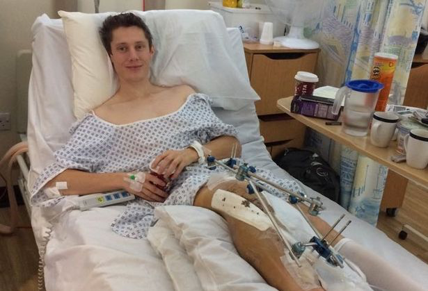 Matt Smith was cut up and forced into the kerb. The driver drove off but then returned to shout abuse, and knocked him down. His leg fracture hospitalised him for 2 weeks. Acquitted of causing his injury, she got a community order and 10pts for careless driving & failing to stop