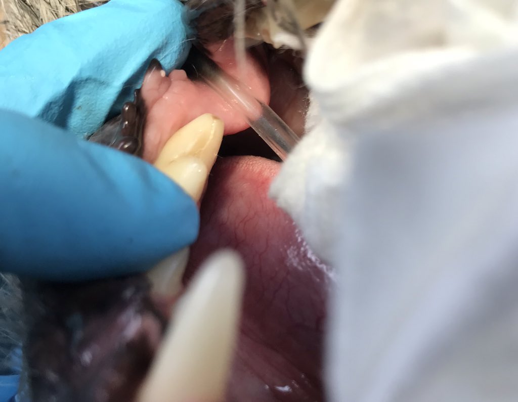 Interesting dental case #2: on closer look, the fracture is longitudinal down the tooth.