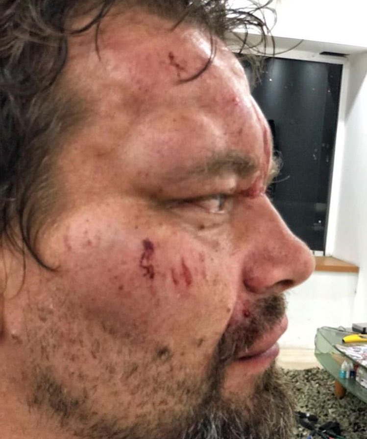 BarbaraUSanz's tweet photo. #URGENTE El periodista polaco, Tomasz Surdel, del diario @gazeta_wyborcza,  habría sido detenido en una alcabala del #FAES anoche #14Mar, luego fue brutalmente golpeado por los funcionarios. 
Se desplazaba por Bello Monte - Caracas.
Está en #Venezuela desde hace dos meses https://t.co/PYnqo2FMTU