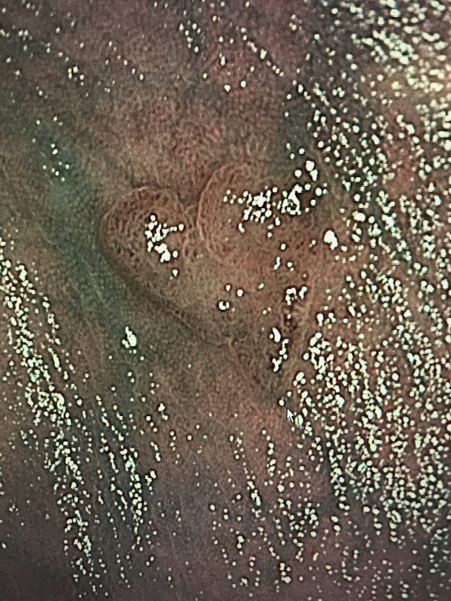 GI_Pearls's tweet image. This was my valentines find #Polypalooza