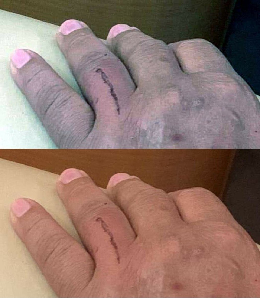 Kejanggalan-kejanggalan Versi Netizen Soal Foto Luka ...