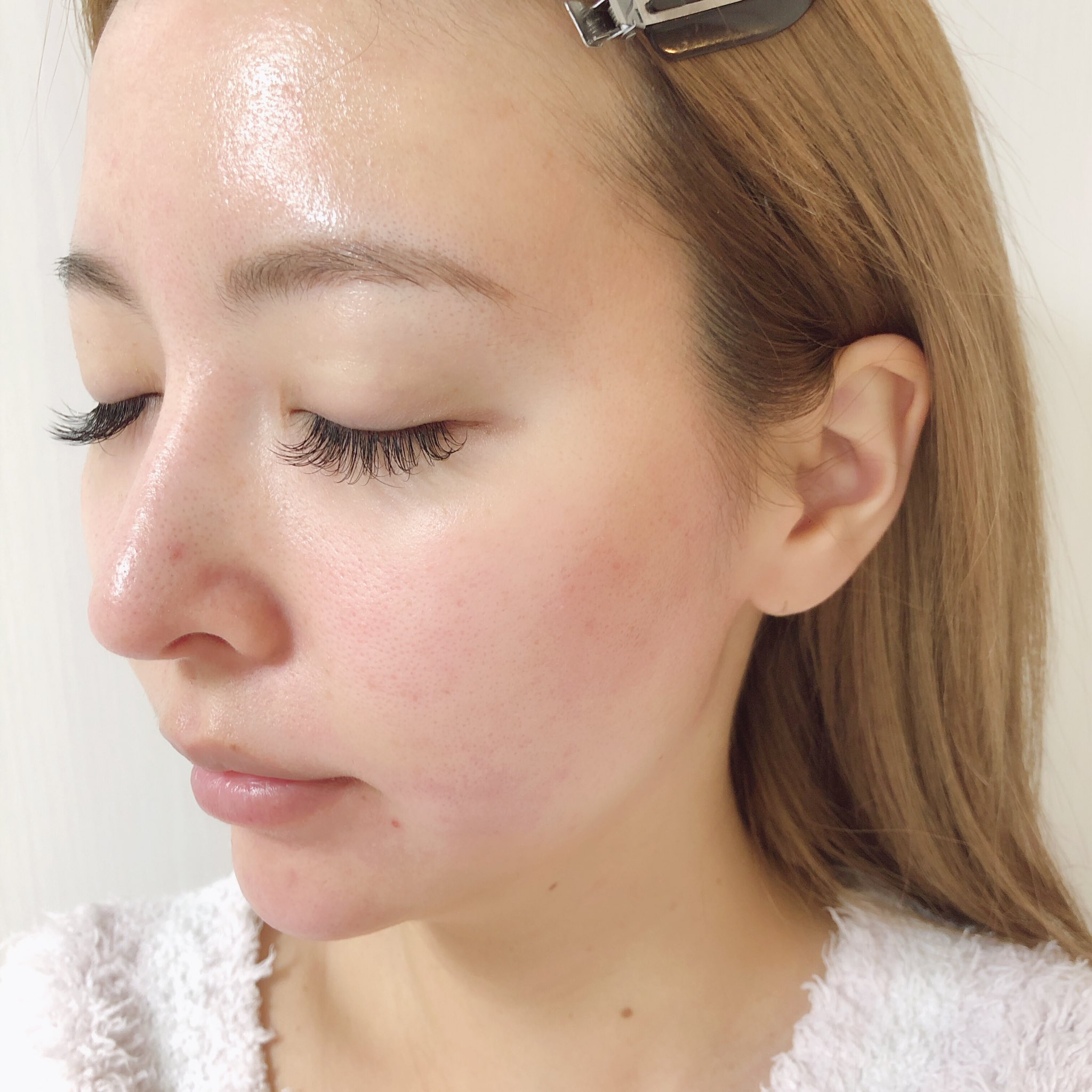 吉川 ちか Sur Twitter 花粉症で肌荒れ起こしてるので リアルな肌載せてみた 花粉本当に辛すぎるから やめてくれ 顔が 痒い痒いかゆい めっちゃ敏感になってるよ 花粉症 T Co T0vooiqmu2 Twitter