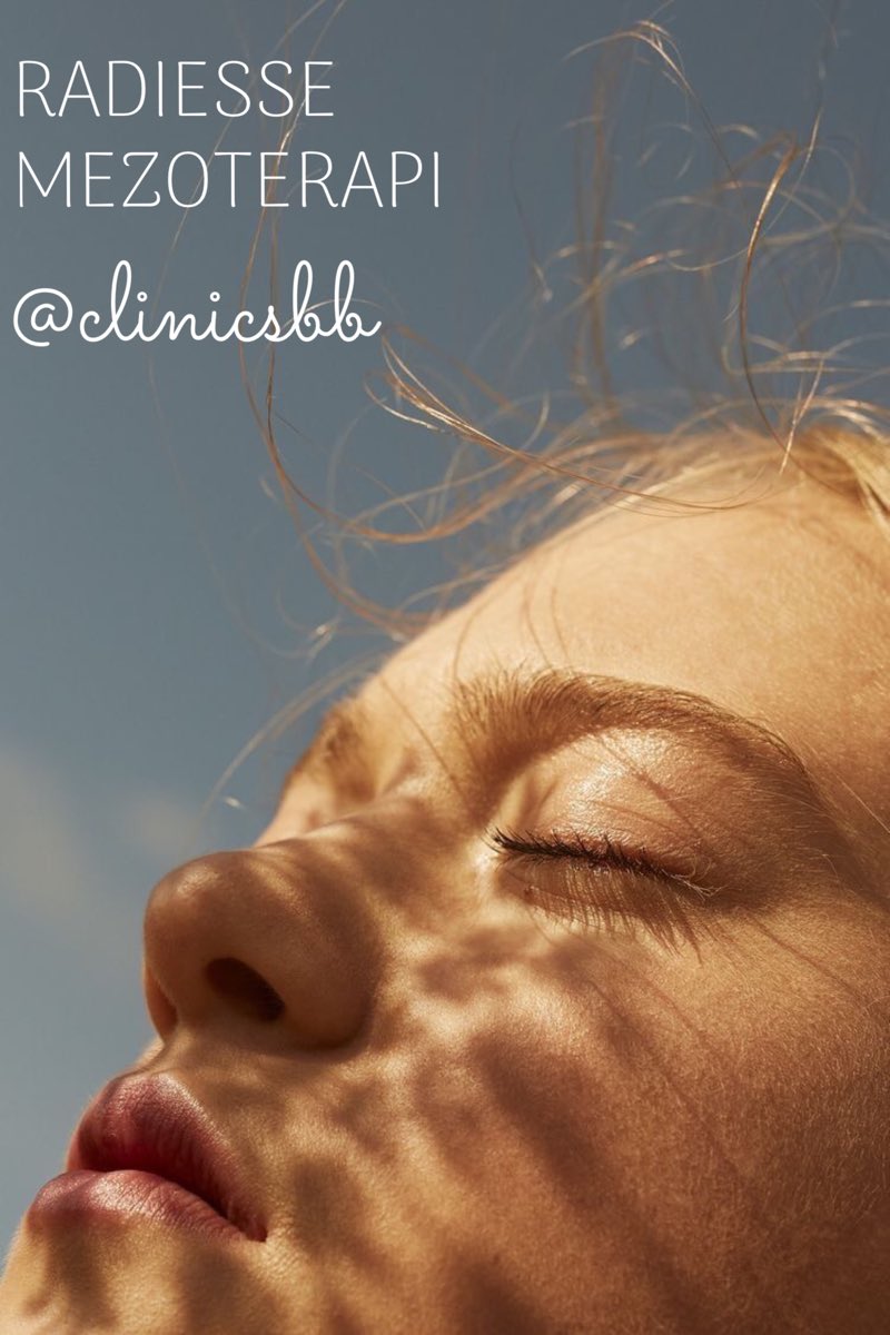 ☘️✨Radiesse Mezoterapi yaptıralım mı? ✨☘️Radiesse Mezoterapi, ince kırışıkların giderip cildin kolajen üretimini arttırır. Böylece cildimiz daha parlak ve berrak bir görünüme kavuşur. ✨✨
#serdarborabayraktaroglu #clinicsbb #radiesse #radiessedolgu #dolgu #radiessemezoterapi