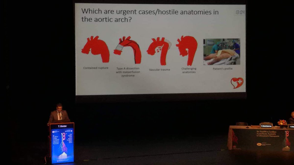 Presenting alternative endovascular techniques for urgent cases and hostile anatomies of the aortic arch during the 18th Hellenic Symposium of Vascular Surgery #endovasculargr #athensmedicalcenter