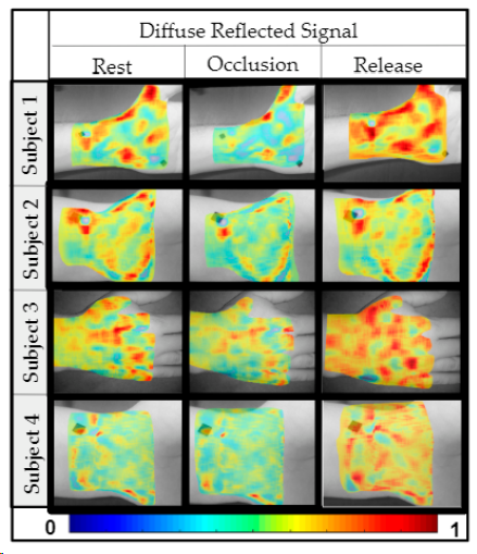FScholkmann's tweet photo. A Smartphone-Based Near-Infrared Optical Imaging Device to Measure Physiological Changes In-Vivo -> https://t.co/2z0eQtiRpm #biomedicaloptics https://t.co/TIURote7hc