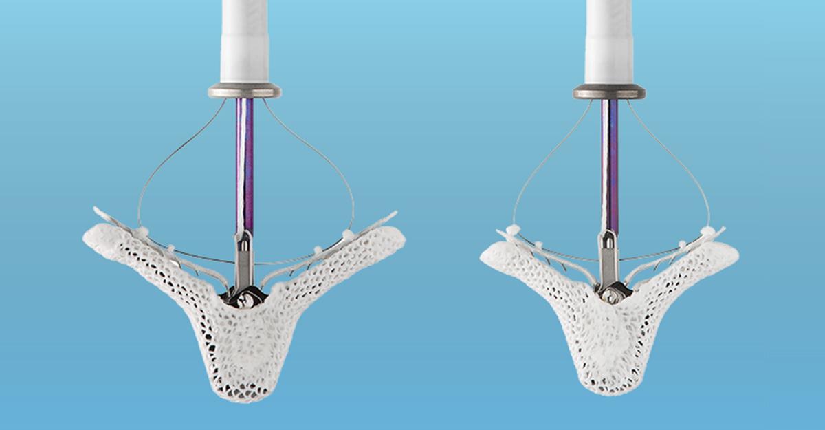 AbbottNews's tweet photo. In over a decade of use, more than 80,000 people worldwide have benefited from MitraClip. The FDA’s decision means the device is now in position to help many thousands more: https://t.co/xf3WaZEjtv #healthtech 

Important safety info: https://t.co/PWY6KXUls8 https://t.co/dMFFSdJSWr