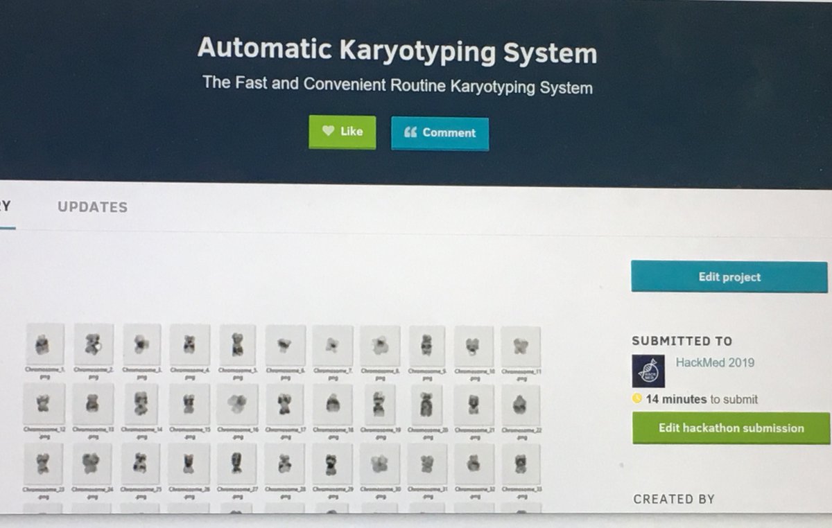 nazia_ahmed1's tweet photo. With less than 15 minutes to go until the Hackathon ends, and we’ve nearly finished our Automatic Karyotyping System have submitted in Devpost! 😁 #HackMed19 @thedevacademy @MLHacks @hackmeduk https://t.co/7u45yipdUJ