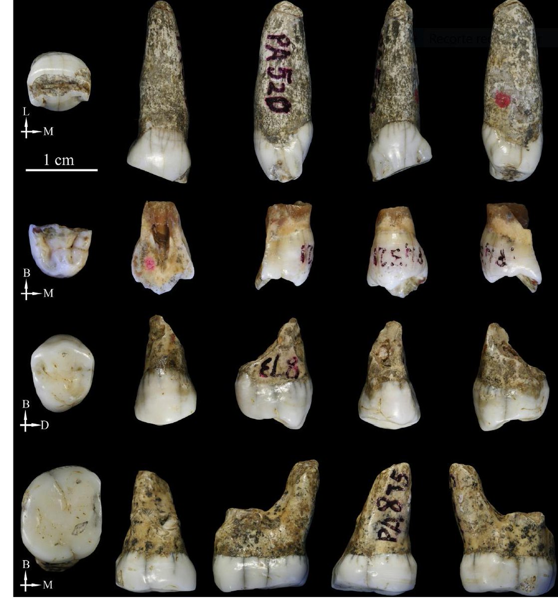 Our new paper on the late Middle Pleistocene teeth from Tongzi (southern China) is out. Another "non-erectus" sample to search for Denisovans? <a href="/CENIEH_Labs/">CENIEH Labs</a> <a href="/CENIEH/">CENIEH</a> <a href="/Jmbdecastro/">JM Brmdez de Castro</a> #ictsnews sciencedirect.com/science/articl…