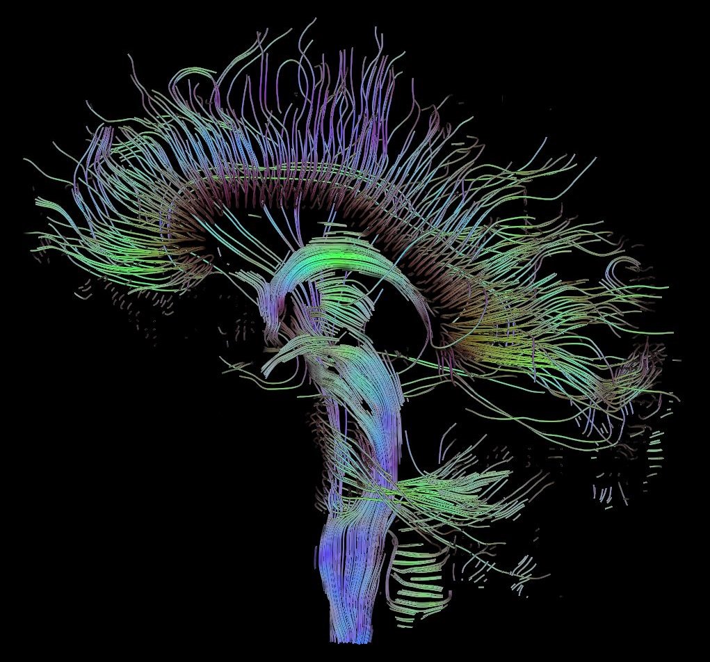 Stemcellmeet's tweet photo. A single population of #stemcells contributes to lifelong hippocampal neurogenesis To know more join us @ https://t.co/6pvuuj4oFH
#CellScience2019 #Paris #Conference https://t.co/TSx1XqFL6I