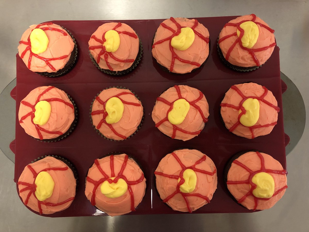 mariastunkelMD's tweet photo. Celebrating last day of glaucoma clinic with CUPcakes π§ #totalcupping #cuppedout #glaucoma #ophthalmology #medtwitter #meded #ophtholife #optometry https://t.co/8NQjoAH4Z6