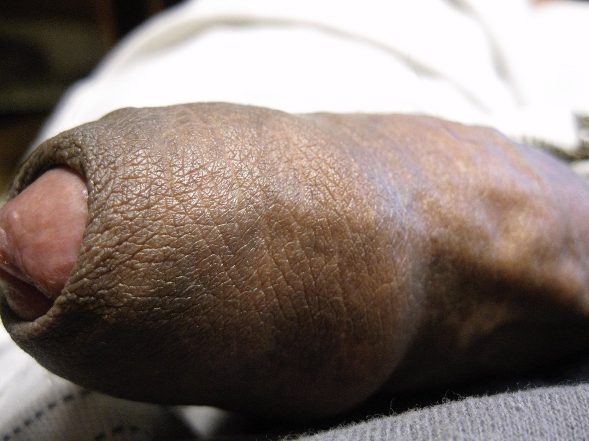 blknate666's tweet photo. foreskin friday! #prepucio #prepuce #foreskin #uncut #blackdick #teamuncut https://t.co/8gNgabKZUE