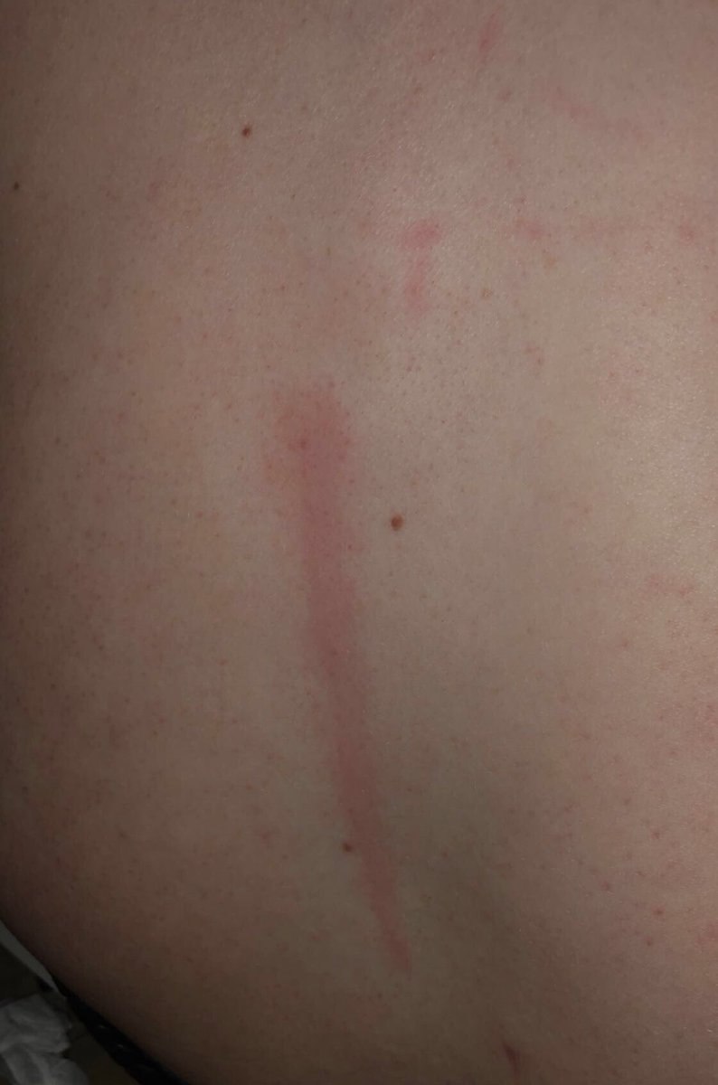 Just left <a href="/Zak_Bagans/">Zak Bagans 🧛🏻‍♂️</a> museum. {<a href="/hauntedmuseum/">Zak Bagans' The Haunted Museum</a> } and my husband got a pain in is back in the parking lot. Come to find, his back was scratched. Stuffs no joke.